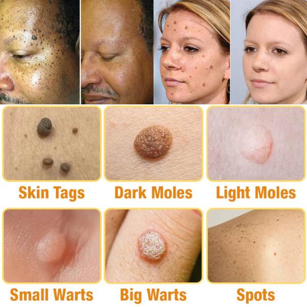 TagRecede Bee Venom Treatment Spray YT2