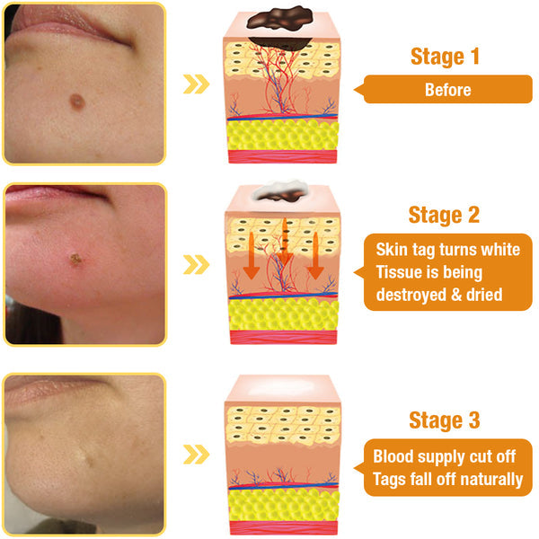 TagRecede Bee Venom Treatment Spray YT2