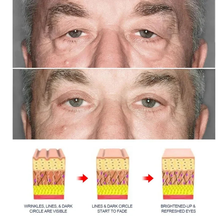 Awaken Peptide Lifting Eye Gel YT